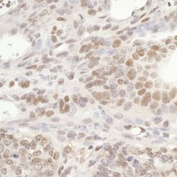 GTF3C5 Antibody, Novus Biologicals 0.1mL; Unlabeled:Antibodies, Polyclonal